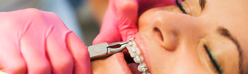 Remboursement des soins et consultations d’orthodontie pour les adultes