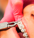 Remboursement des soins et consultations d’orthodontie pour les adultes